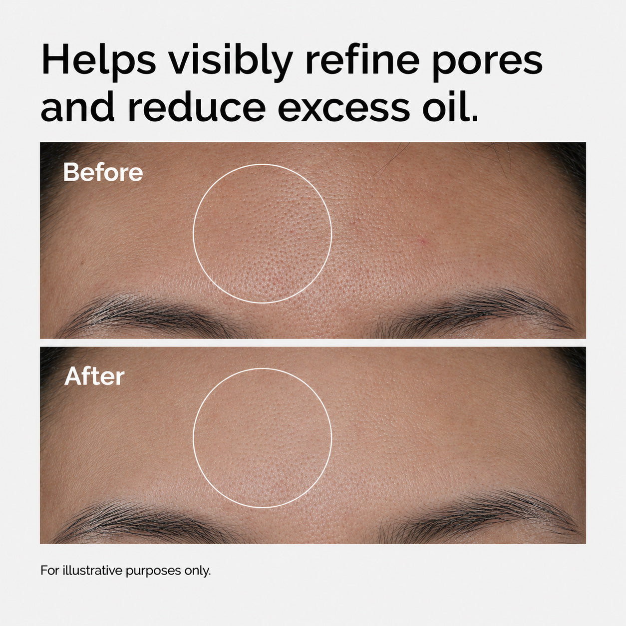 Niacinamide 10%